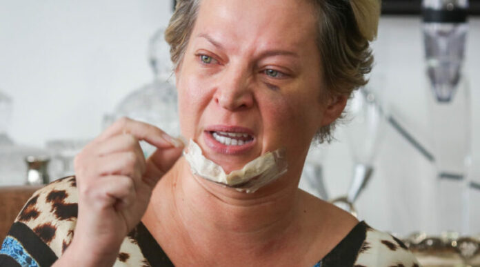 A verdade sobre o ocorrido com Joice Hasselmann