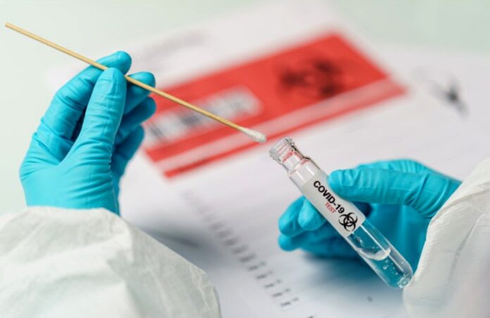 O perigo do FALSO NEGATIVO no teste SOROLÓGICO de COVID-19